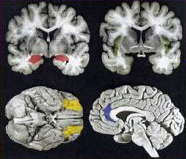 neurobiologie-psychotherapie.jpg neurobiologie-psychotherapie.jpg