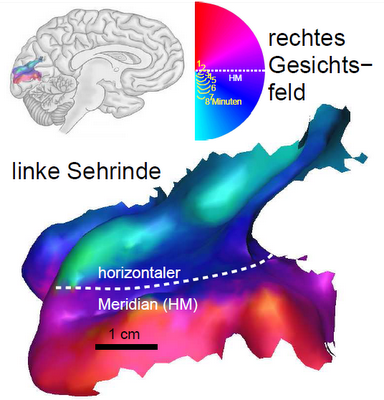 hirnrindenkruemmungsehen.png hirnrindenkruemmungsehen.png